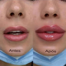 Gloss para Aumento Labial - Lip Plump Gloss para Aumento Labial - Lip Plump Importe Go 
